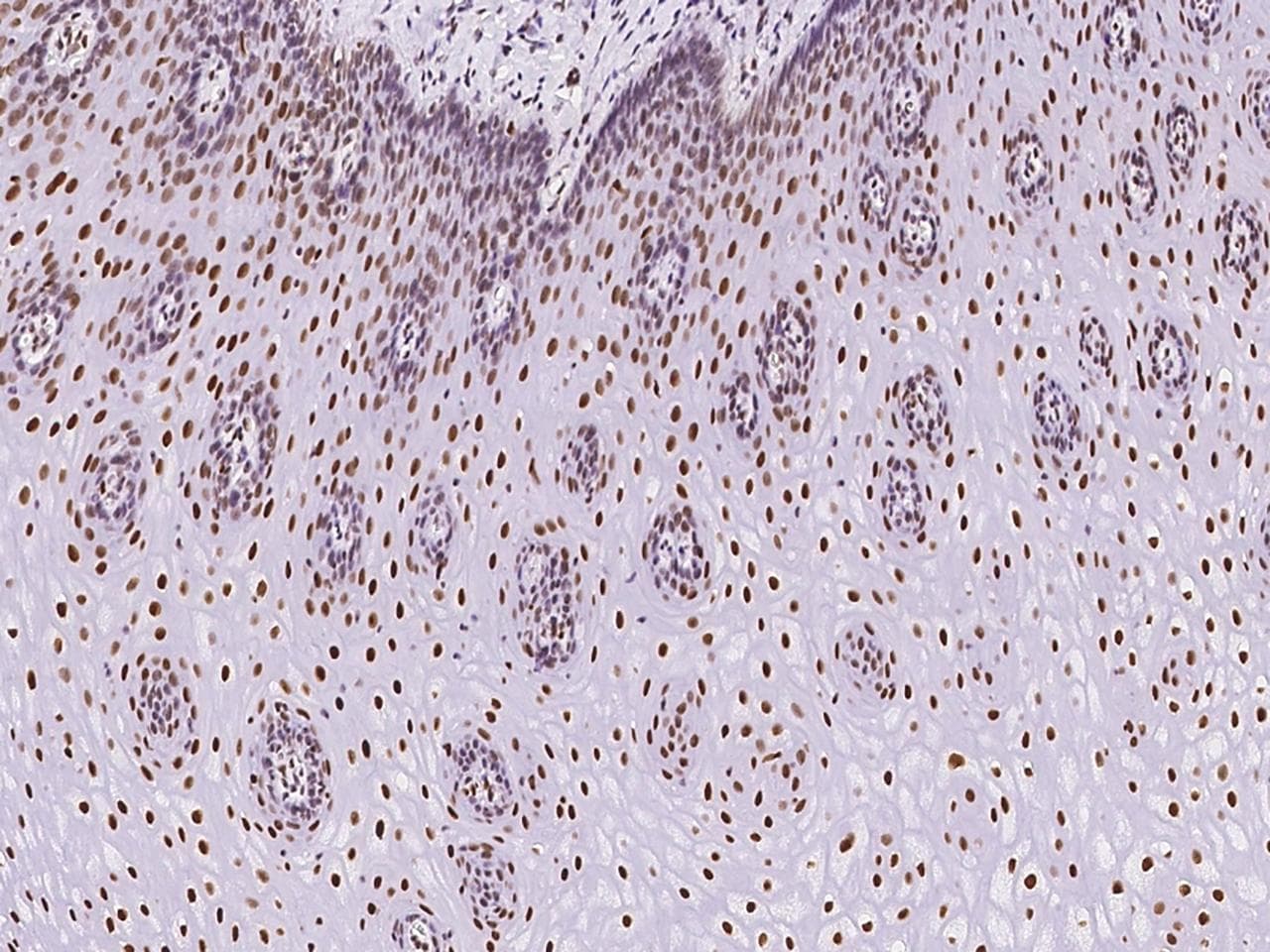 PCYT1A / CCT Alpha Antibody