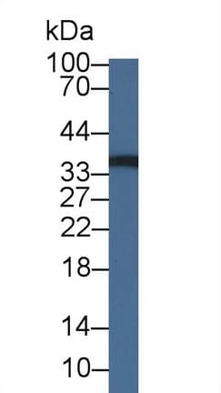 RCAN2 / RCN2 Antibody (aa26-301)