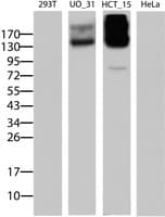 Monoclonal Mouse anti-Human ABCB1 / MDR1 / P Glycoprotein Antibody (clone OTI2C7, IHC, WB)