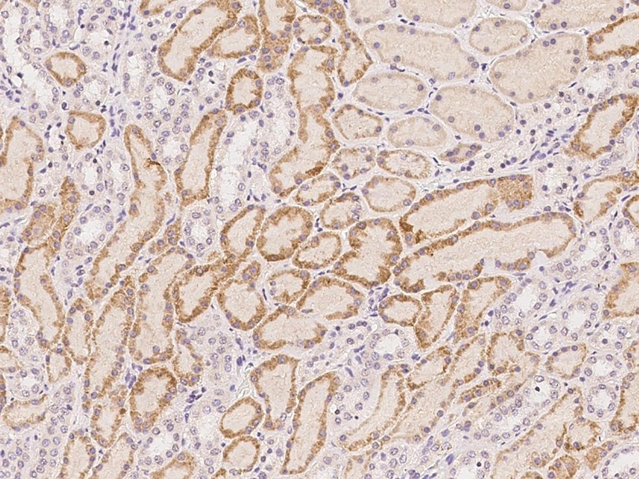 Polyclonal Rabbit anti-Human ACSF2 Antibody (IHC)