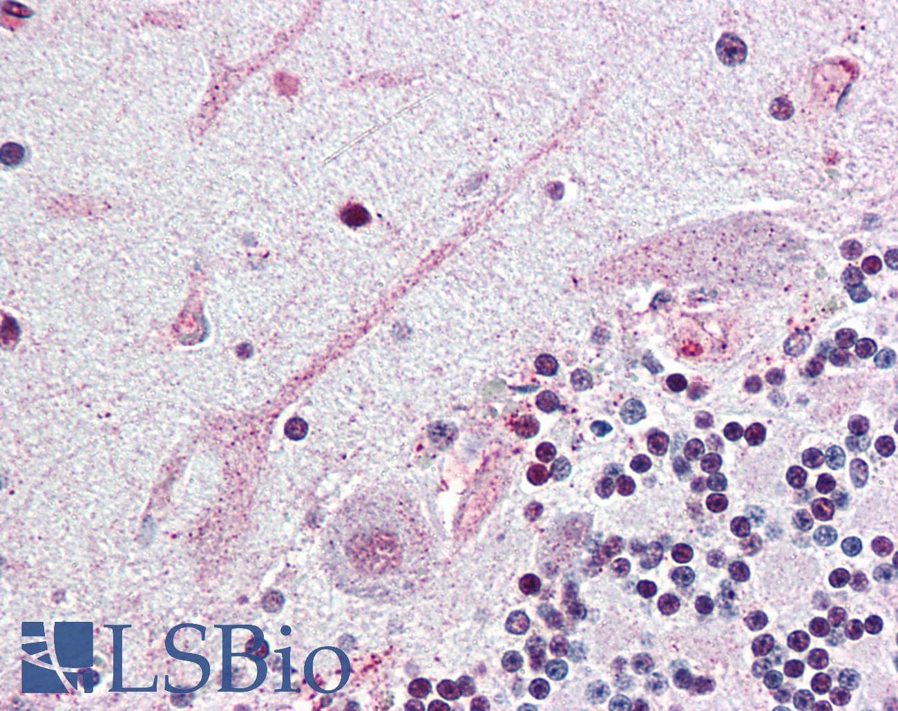 IHC-plus™ SCN3A / Nav1.3 Antibody (Internal)