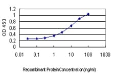 FOXC2 Antibody (clone 2H3)
