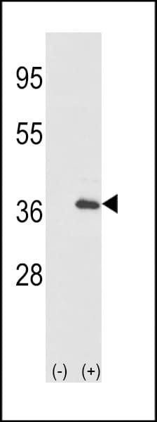 IL1A / IL-1 Alpha Antibody (aa65-94)