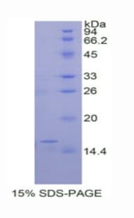 Rat TTR / Transthyretin Protein (Recombinant His)