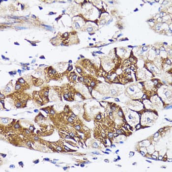 Polyclonal Rabbit anti-Human BAP29 / BCAP29 Antibody (IHC, WB)
