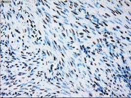 BRAF / B-Raf Antibody (clone OTI4C11)