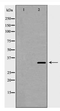 CCND2 / Cyclin D2 Antibody