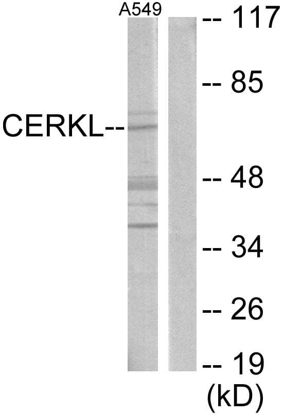 CERKL Antibody