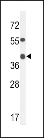 ADH4 Antibody (aa319-348)