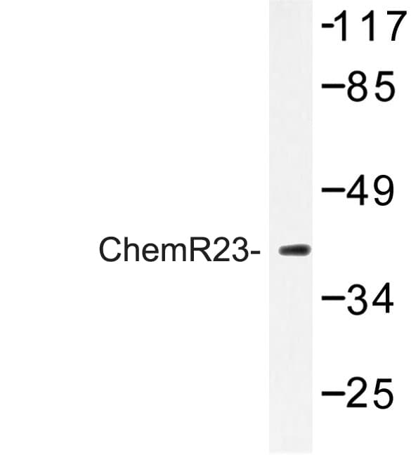 CHEMR23 / CMKLR1 Antibody (Arg249)
