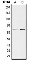 Polyclonal Rabbit anti-Human TESK1 Antibody (Internal, WB)