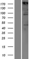 TIAM1 Protein (Over-Expression Lysate Myc-DDK (Flag))