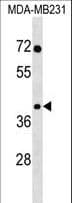 SNAPC3 Antibody (aa145-171)
