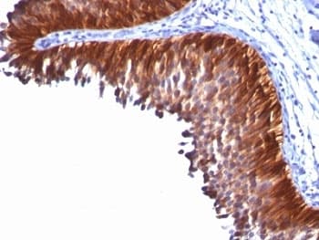 KRT18 / CK18 / Cytokeratin 18 Antibody (clone KRT18/834)