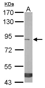 TREH Antibody (aa7-285)