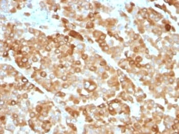 Tyrosinase Antibody (clone OCA1/812, Ready-to-Use)