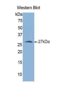 Polyclonal Rabbit anti-Human NOG / Noggin Antibody (aa28-232, WB)