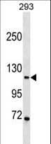 PR / Progesterone Receptor Antibody (aa816-843)