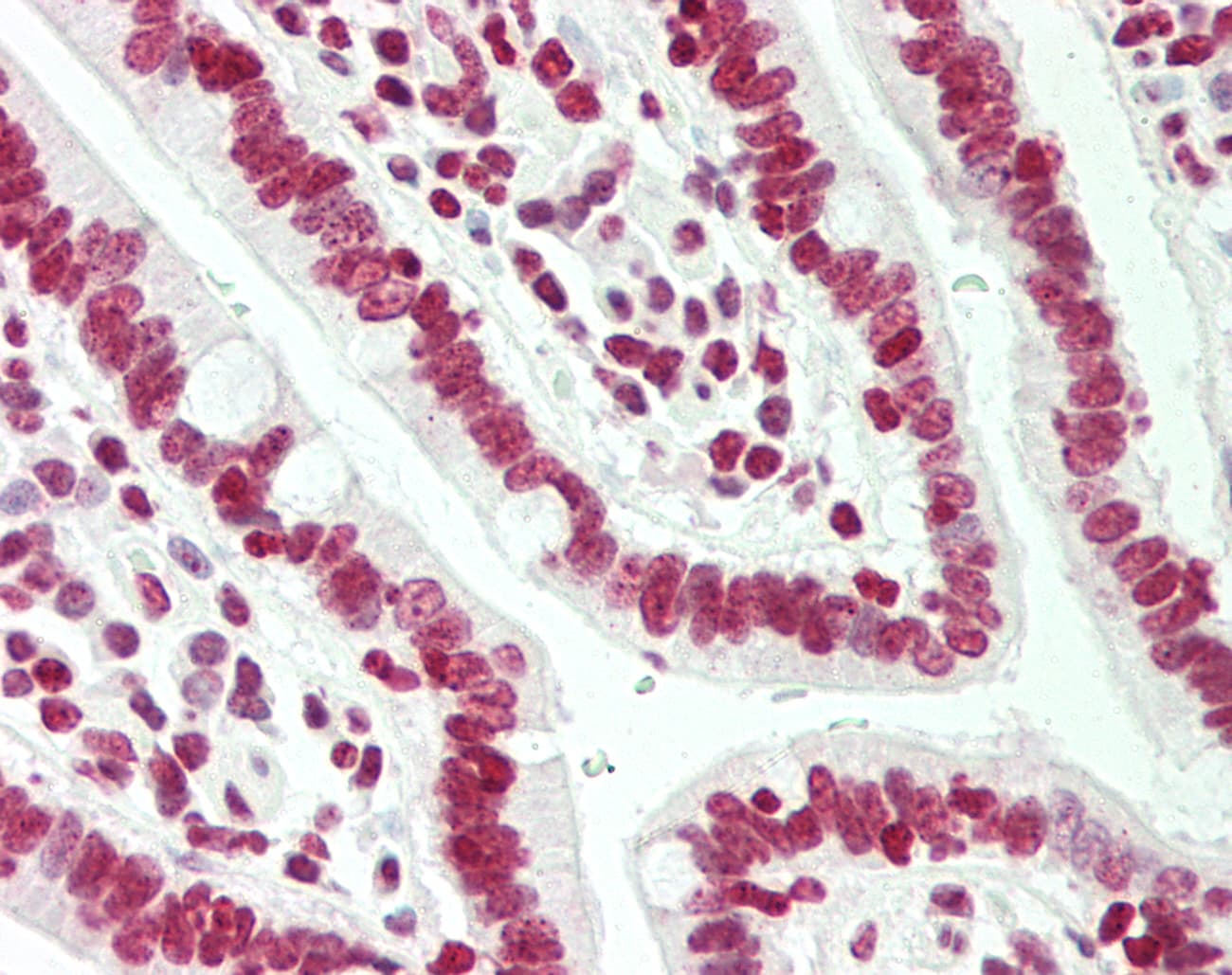 IHC-plus™ Polyclonal Rabbit anti-Human HMG1 / HMGB1 Antibody (IHC, IF, WB)