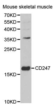 Polyclonal Rabbit anti-Human CD247 / CD3 Zeta Antibody (IHC, IF, WB)
