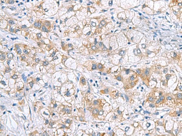 Polyclonal Rabbit anti-Human GCSH Antibody (IHC)