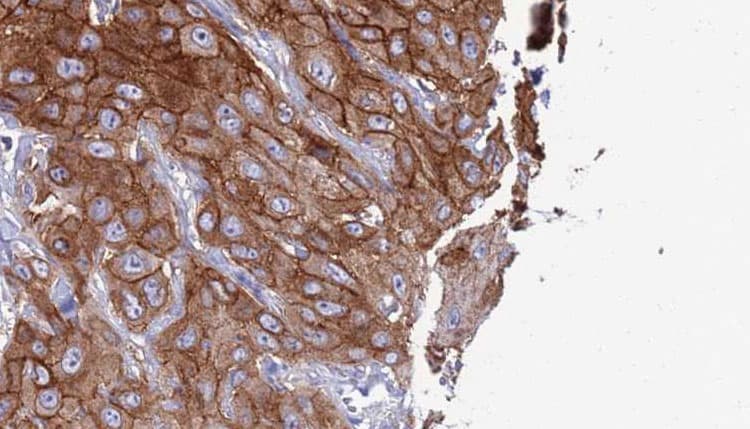 CLECSF6 / DCIR Antibody