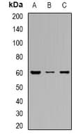 Polyclonal Rabbit anti-Human SLC22A8 / OAT3 Antibody (WB)