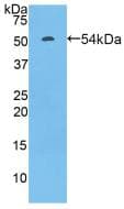 FCGR3A / CD16A Antibody (aa5-241)