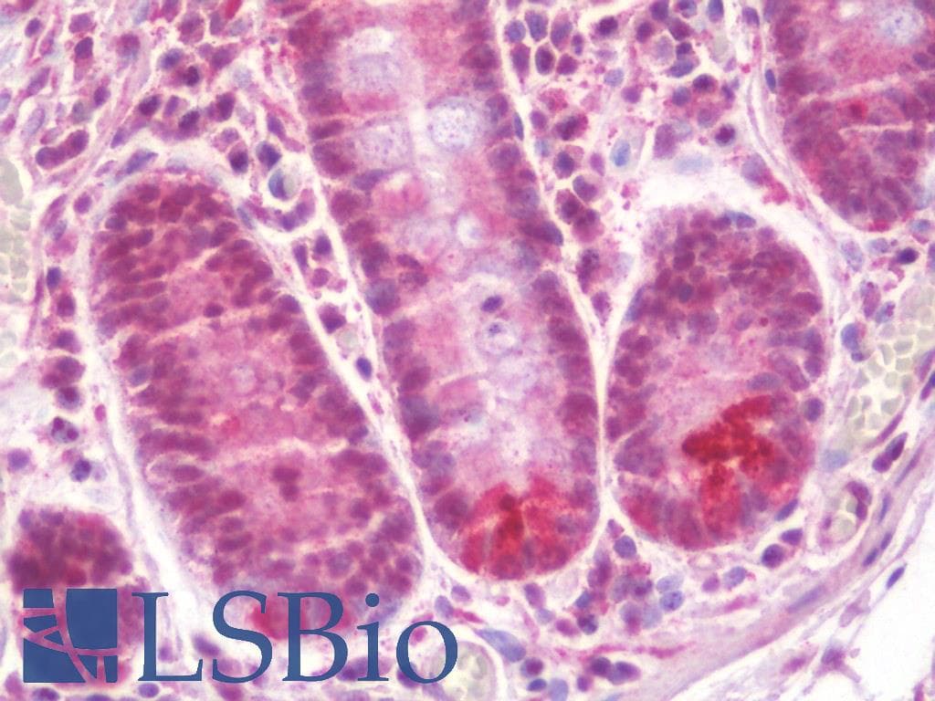 IHC-plus™ FCHSD1 Antibody