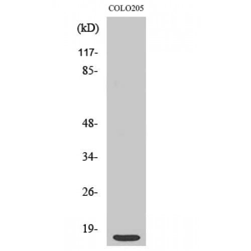 Polyclonal Rabbit anti-Human RPS12 / Ribosomal Protein S12 Antibody (60-140 aa, C-terminal, IHC, IF, WB)