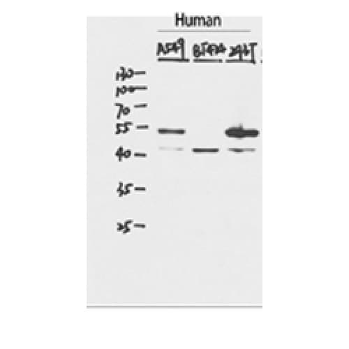 Polyclonal Rabbit anti-Human TP53 / p53 Antibody (270-350 aa, C-terminal, IHC, IF, WB)