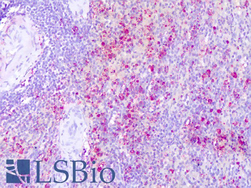 PathPlus™ Polyclonal Rabbit anti-Human CX3CR1 Antibody (Extracellular Domain, IHC)