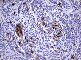 TS / Thymidylate Synthase Antibody (clone OTI5H8, Carrier-free)