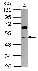 TRIP13 Antibody