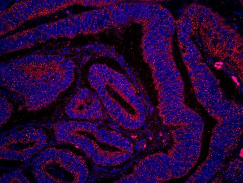 Polyclonal Rabbit anti-Human PTEN Antibody (C-Terminus, IHC, IF)