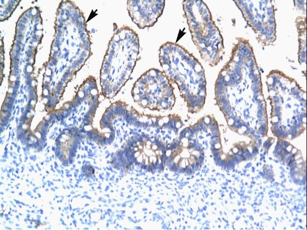 TRIM15 Antibody (aa141-190)