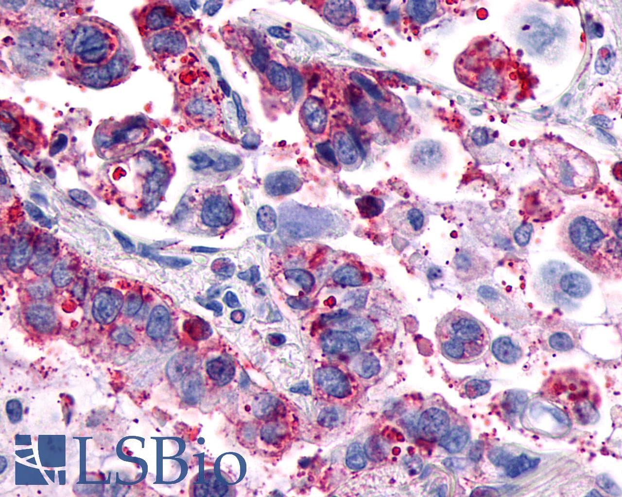 PathPlus™ GPR4 Antibody (Cytoplasmic Domain)