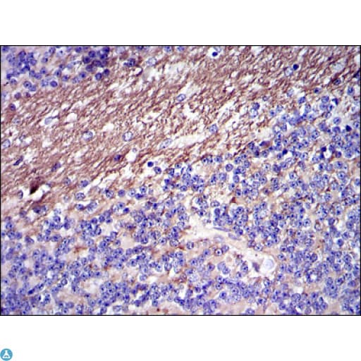 FGG / Fibrinogen Gamma Antibody