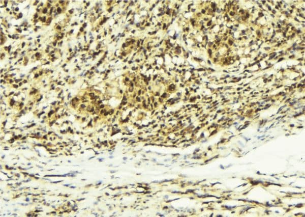 CABIN1 Antibody