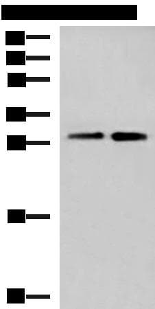 TBCB / CKAP1 Antibody