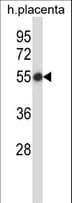 SMARCB1 / INI1 Antibody (aa52-81)