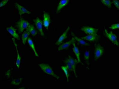 Polyclonal Rabbit anti-Human CDH9 / Cadherin 9 Antibody (IHC, IF, WB)