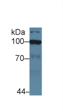 HK2 / Hexokinase 2 Antibody (aa469-669)