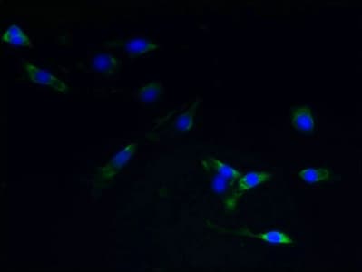 Polyclonal Rabbit anti-Human TACR1 / NK1R Antibody (IHC, WB)