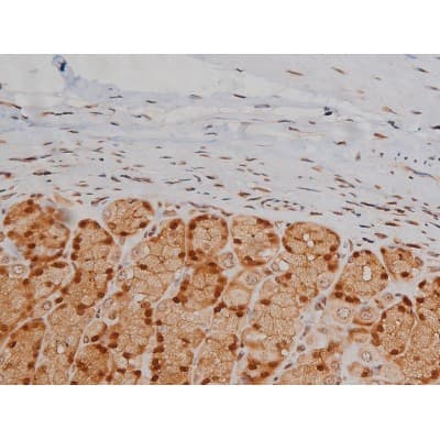 IGF1R / IGF1 Receptor Antibody (phospho-Tyr1346)