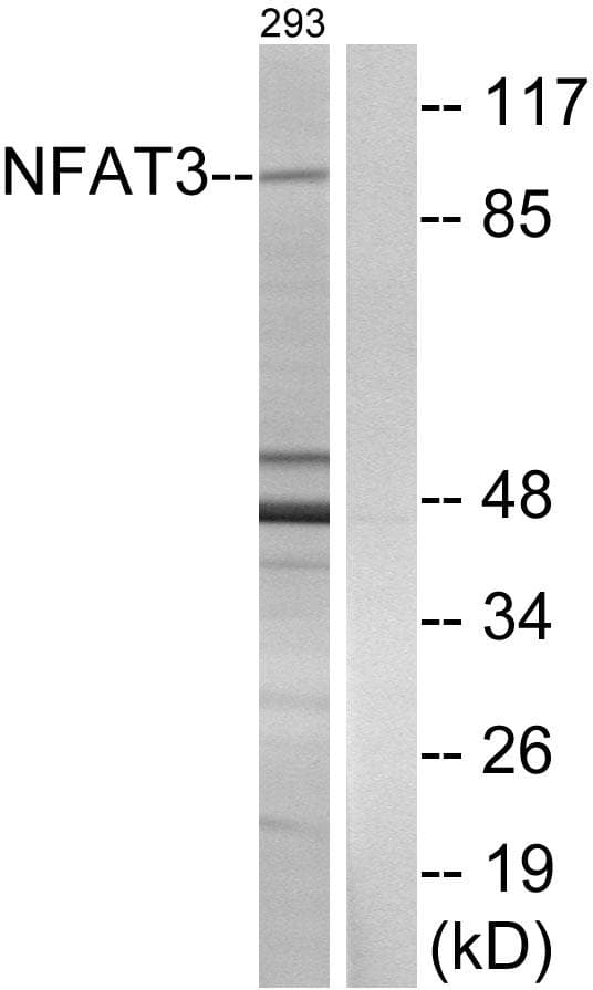 NFATC4 / NFAT3 Antibody (p676)