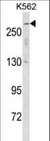 Polyclonal Rabbit anti-Human SCN5A / Nav1.5 Antibody (aa42-70, WB)