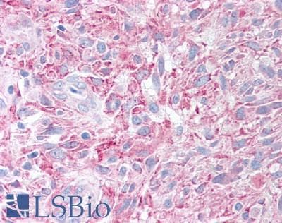 PathPlus™ PLA2G3 Antibody (Internal)