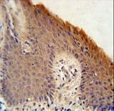 Polyclonal Rabbit anti-Human KRTAP1-1 Antibody (aa88-117, IHC, WB)