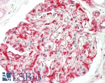IHC-plus™ ABCB10 Antibody (aa441-490)